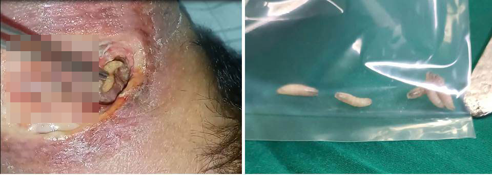 The image of the goji was removed from the patient's necrotic abdomen. Photo: BVCC