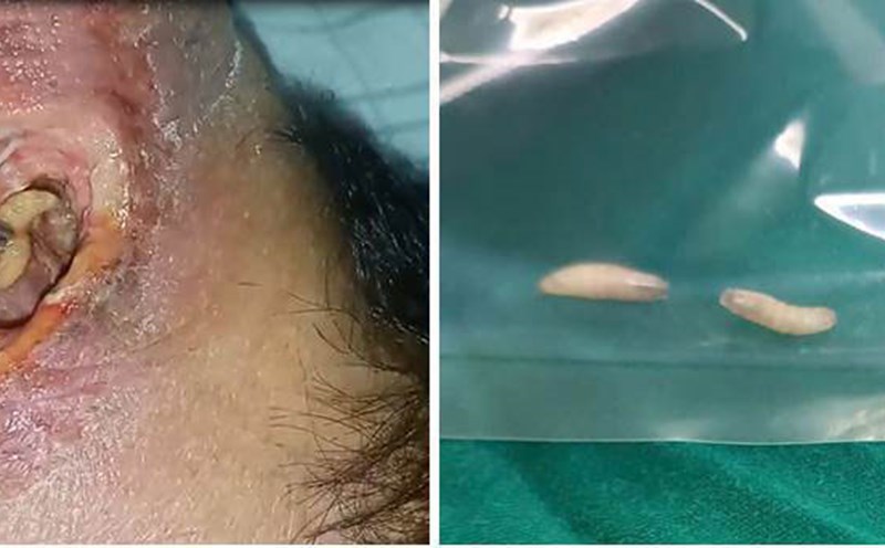 The image of the goji was removed from the patient's necrotic abdomen. Photo: BVCC