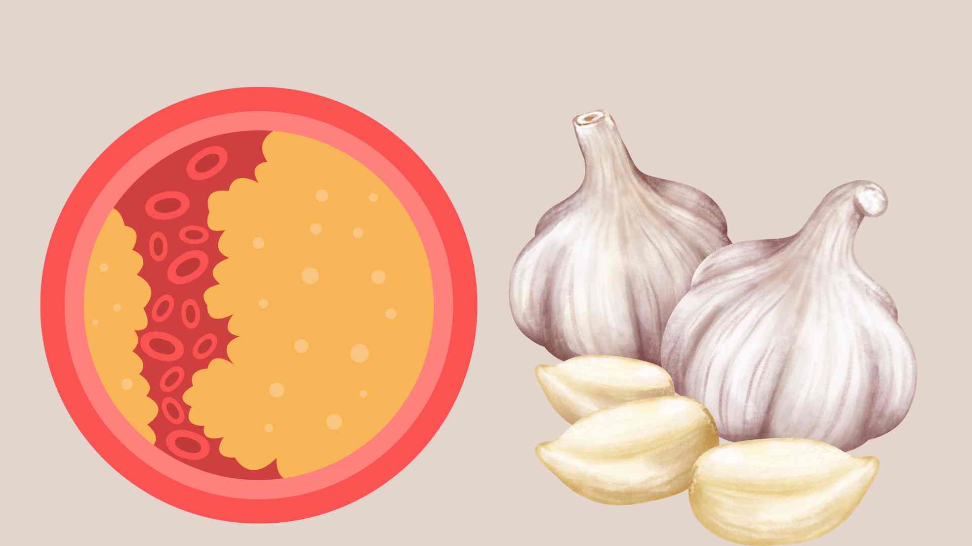 A surprising spice that effectively reduces blood fat. Graphic photo: Hoang Loc