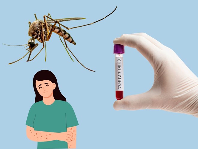 Loài muỗi truyền bệnh sốt xuất huyết có thể khiến bệnh chikungunya lan rộng