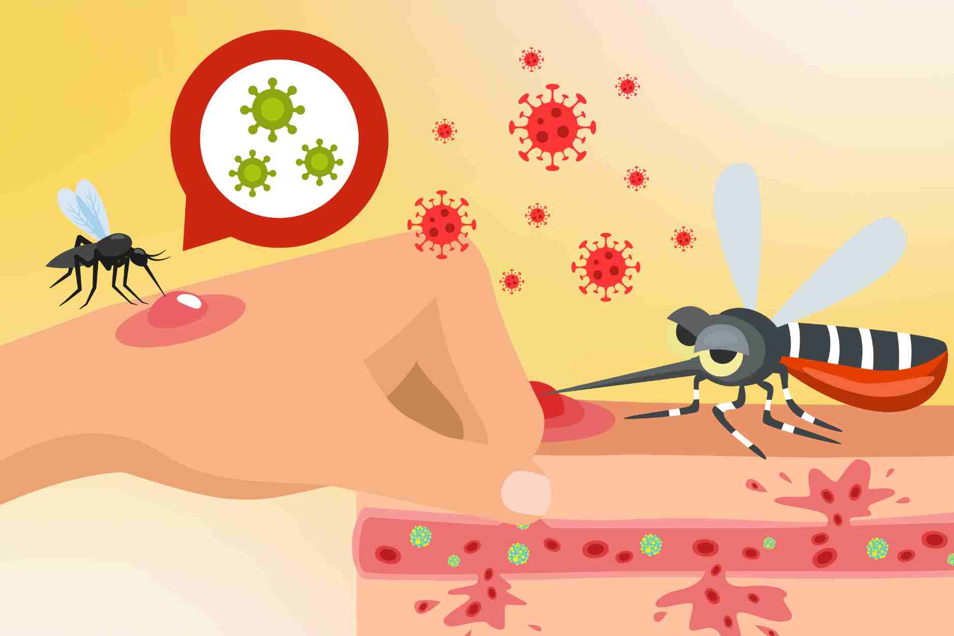 Signs of prolonged and severe Chikungunya virus symptoms