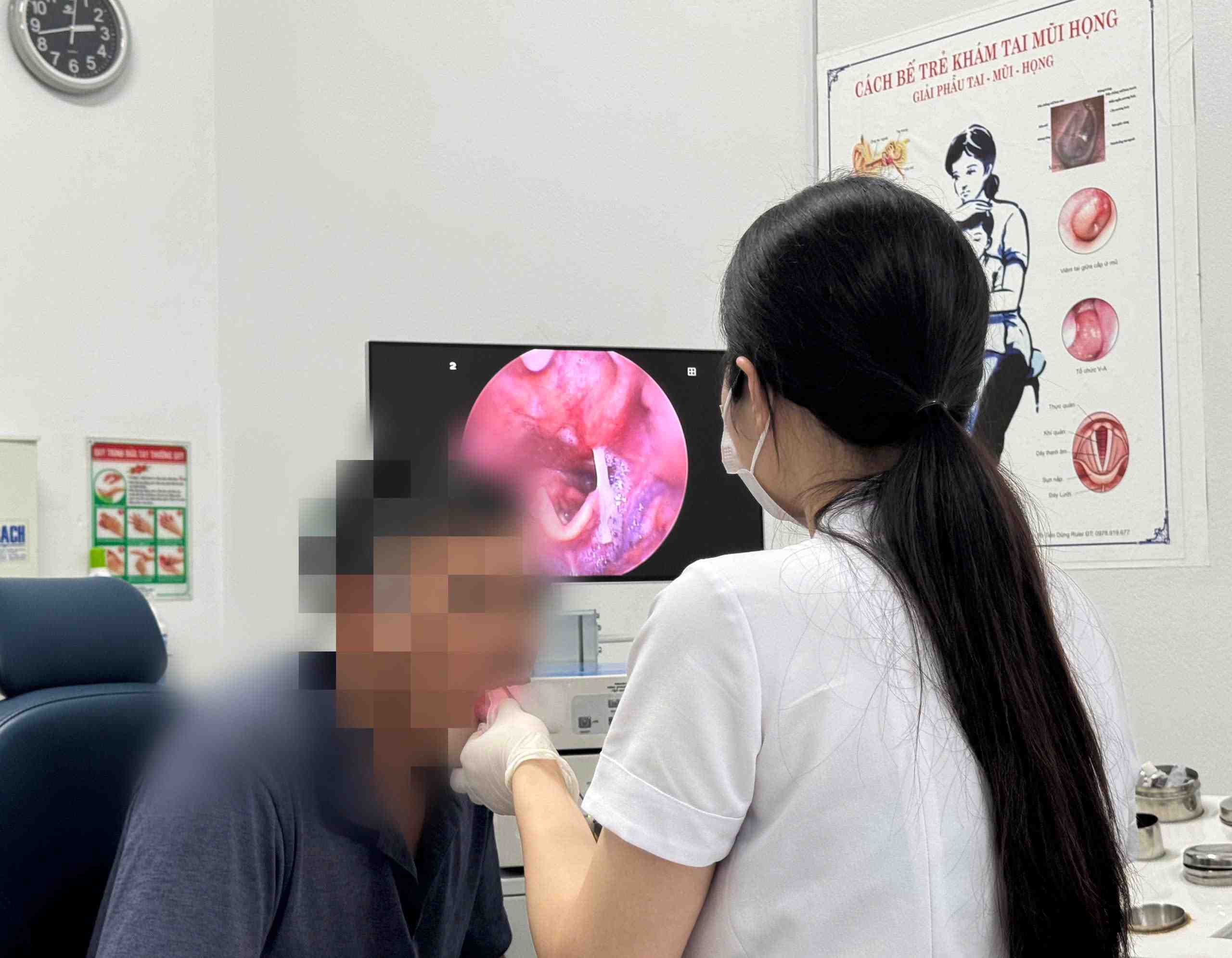 The endoscopist removed the foreign object that was the fish bone for the patient. Photo: Thanh Dang