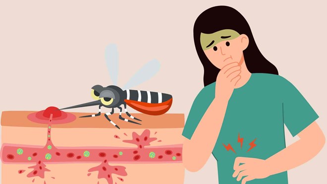 Những triệu chứng cảnh báo bệnh chikungunya bạn không nên bỏ qua