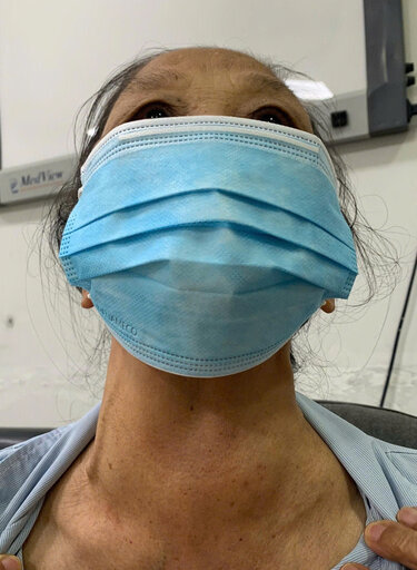 The patient was subjective with a thyroid tumor that was life-threatening. Photo: BVCC