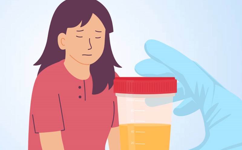 5 warning signs to look out for in urine. Graphics: Thien Nhan