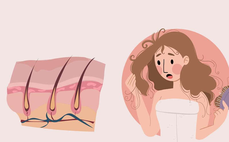 Habits that make hair break easily. Graphic photo: Thai Anh