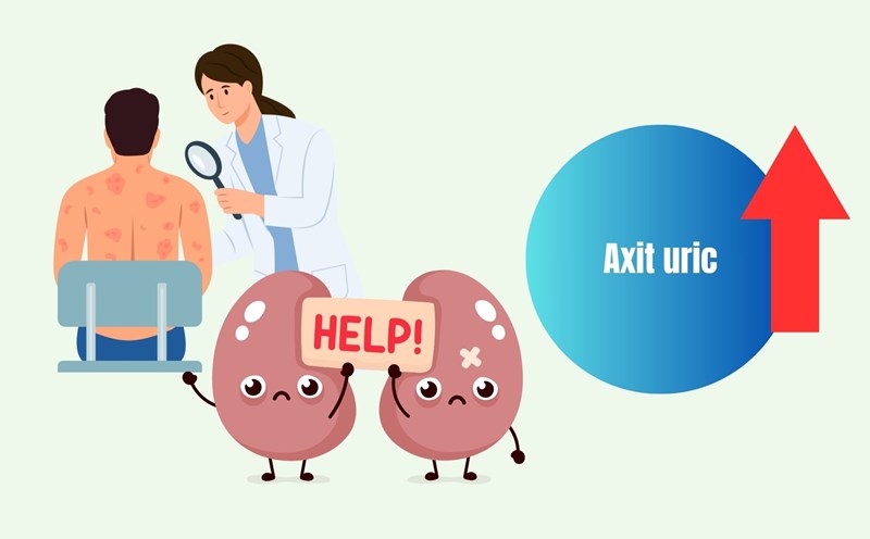 Silent illness causes uric acid to increase. Graphics: Linh Dan