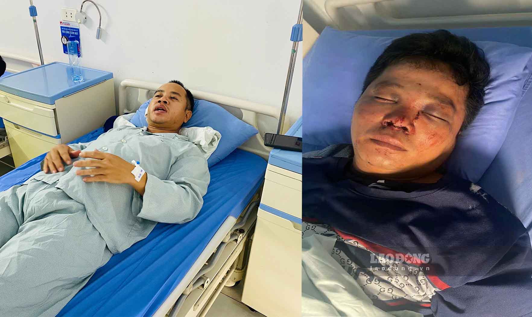 Mr. Vinh (left) and his younger brother were hospitalized after the assault. Photo: Character provided