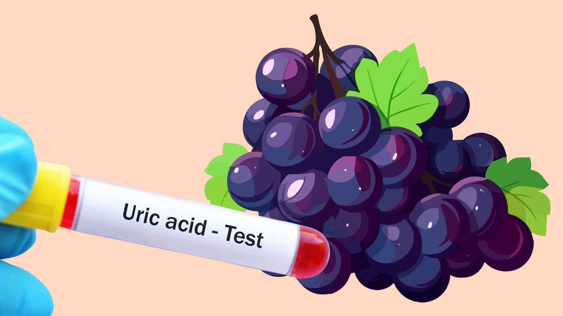 Eating grapes causes uric acid to spike and become uncontrollable. Graphic photo: Huong Giang