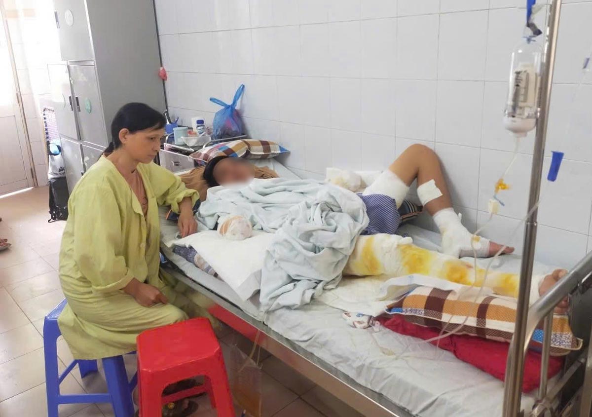 The difficult circumstances of Ms. Do Thi Huong's family in Lien Minh commune, Ninh Binh province need help to treat their son who was electrocuted and had to have his hand amputated, and their daughter who had congenital heart disease. Photo: Provided by the family