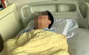 Bị cho là “nhìn đểu”, nam sinh ở Hà Nội bị hành hung gãy xương hàm