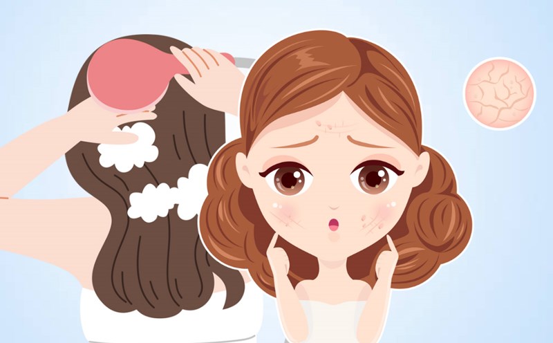 Mistakes when showering every day can make your skin dry and itchy. Graphics: Thien Nhan