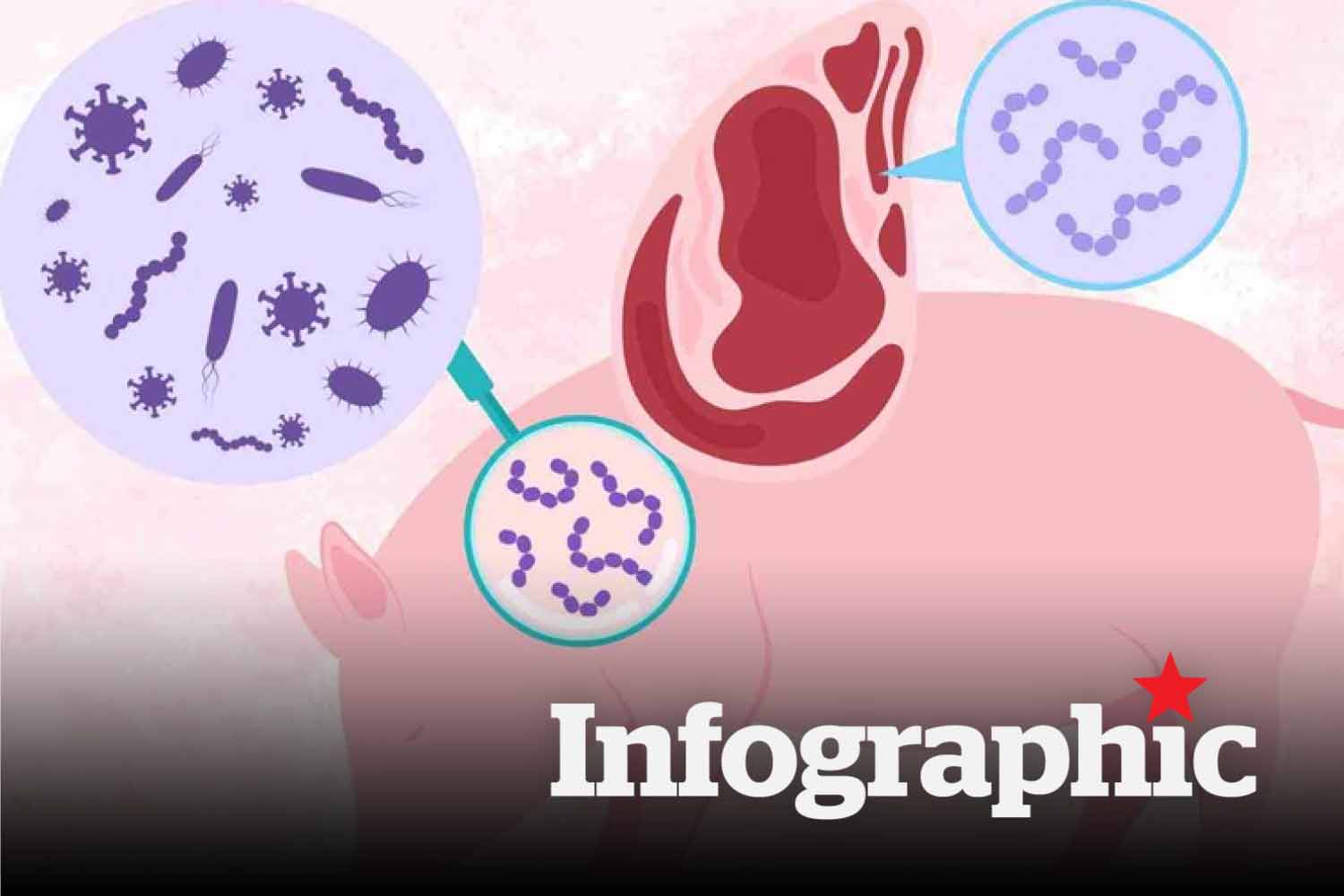 Người đàn ông mắc liên cầu lợn sau nhiều lần ăn lòng lợn, nem chua
