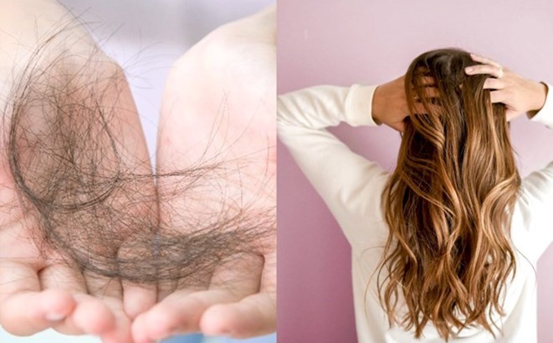 Hair loss at the changing seasons makes many people worry. Graphics: Minh Nhat