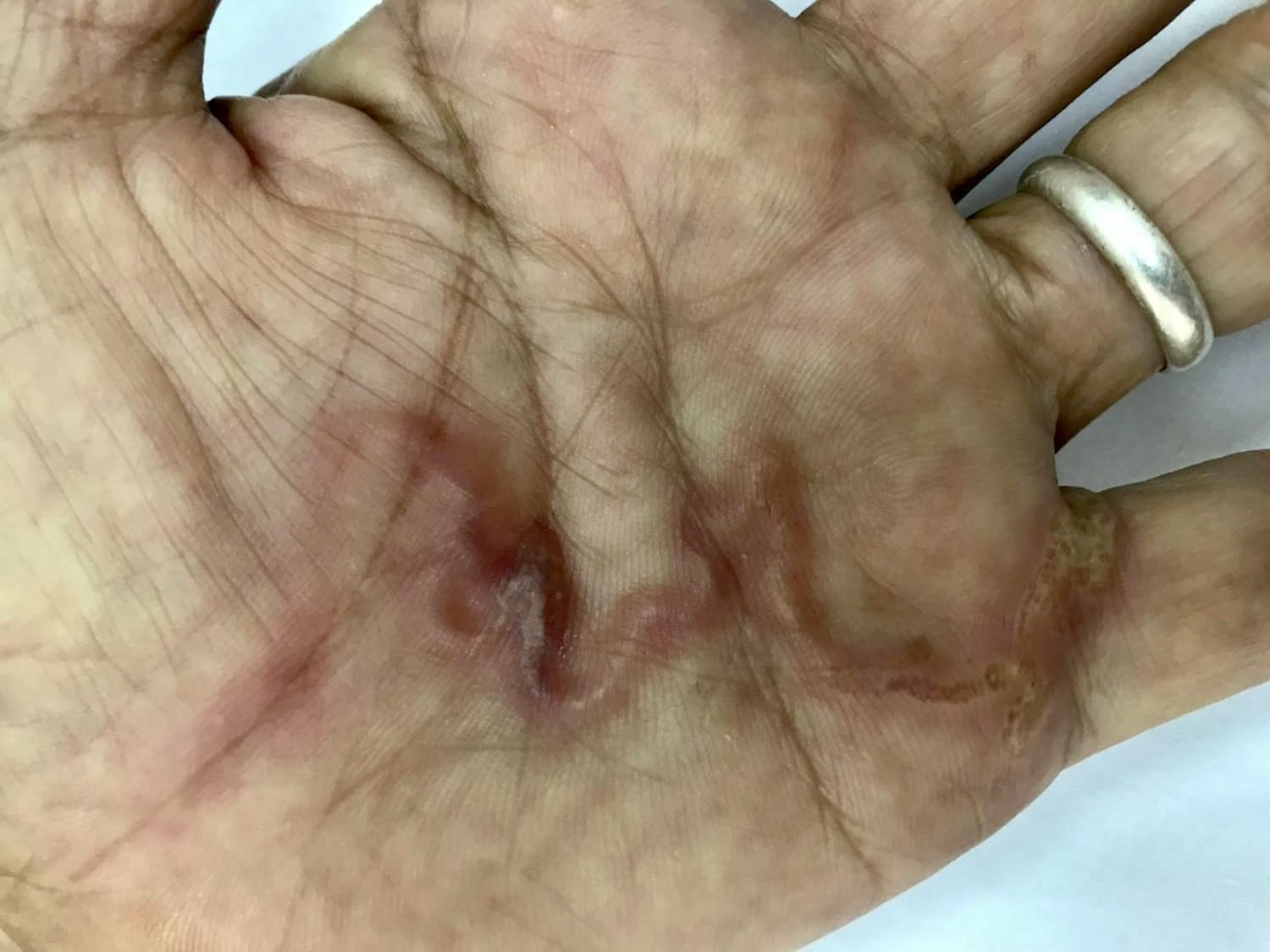 Many people in Khanh Hoa and localities across the country are infected with worm Larvae that attack dogs and cats. Photo: Thuy Linh