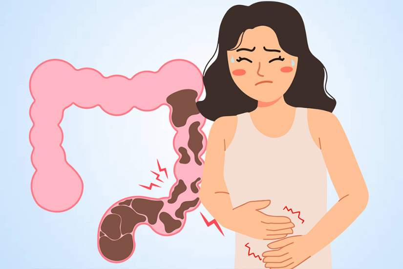 Foods to avoid when you have blocked intestines. Graphics: Thien Nhan