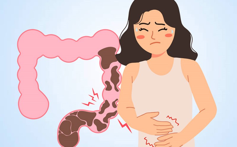 Foods to avoid when you have blocked intestines. Graphics: Thien Nhan