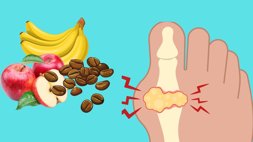 自然な尿酸値を下げるのに役立つ7つの黄金の食品。イラスト:ミー・リン