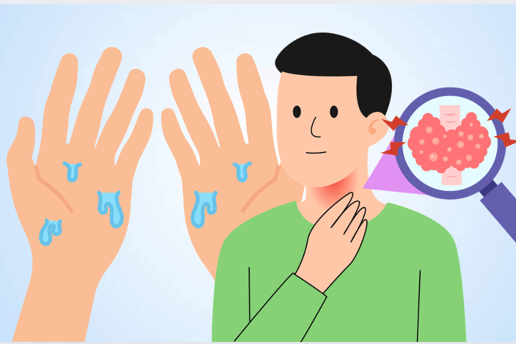 sweating your hands can be a sign of hyperthyroidism. Graphics: Thien Nhan