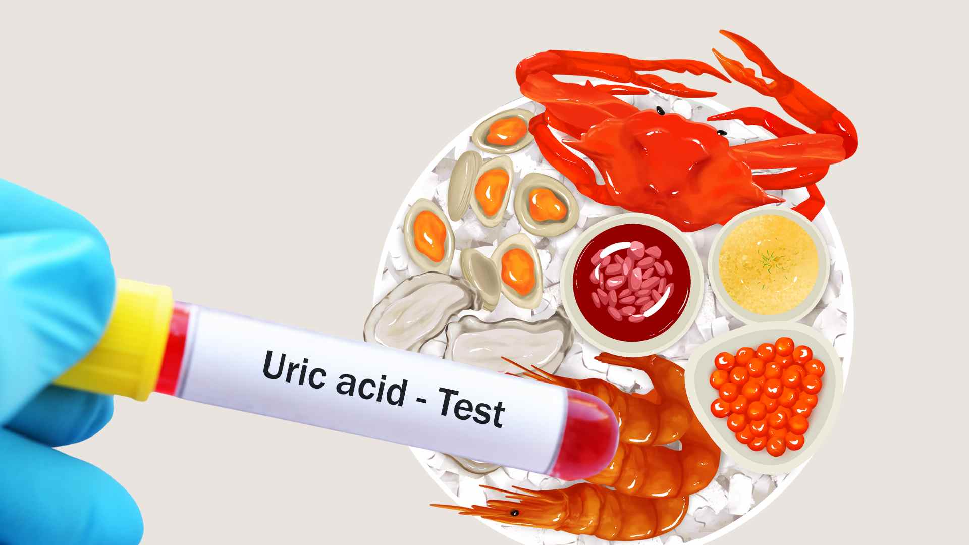 Eating seafood properly does not increase uric acid. Graphic photo: Hoang Loc