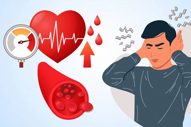 Stress can cause temporary high blood pressure, but if it is prolonged with an unhealthy lifestyle, the risk of progressing to chronic high blood pressure is very high. Graphics: Thien Nhan