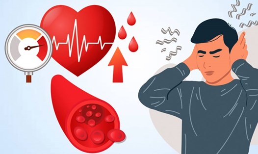 Căng thẳng có thể gây huyết áp tăng tạm thời, nhưng nếu kéo dài kèm lối sống kém lành mạnh, nguy cơ tiến triển thành tăng huyết áp mạn tính rất cao. Đồ họa: Thiện Nhân