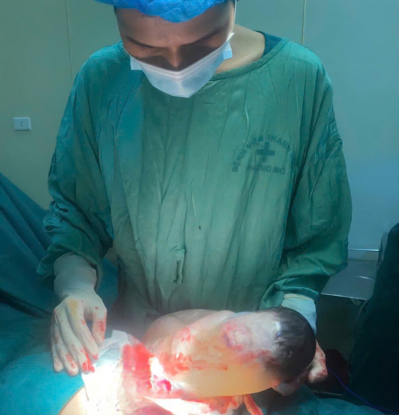 羊膜包みの中で無事に生まれた新生児。写真:BVCC