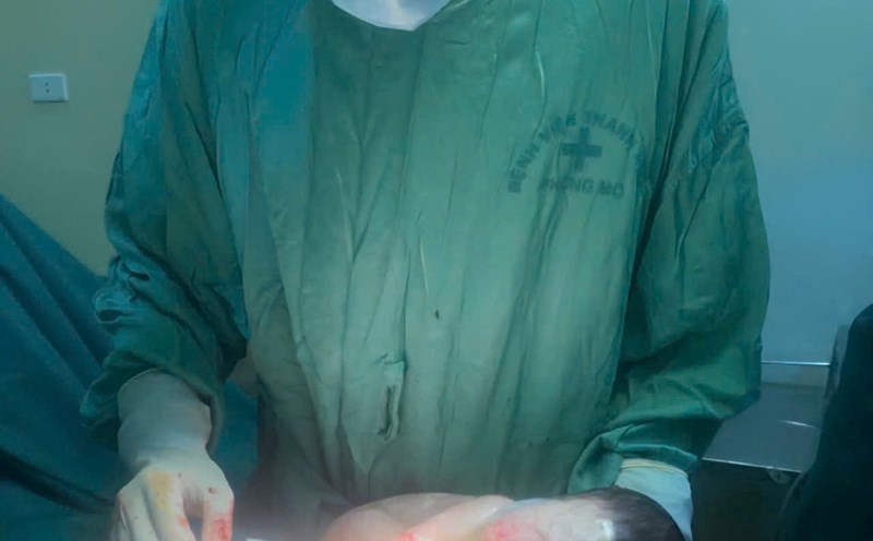 The newborn baby was born whole in a mist. Photo: BVCC