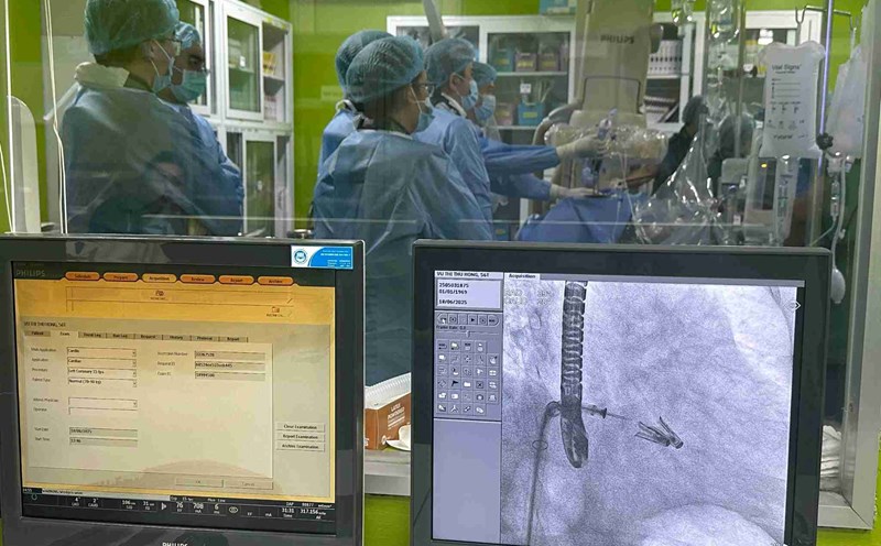 Cardiovascular disease is getting younger. Photo: Phuong Vy