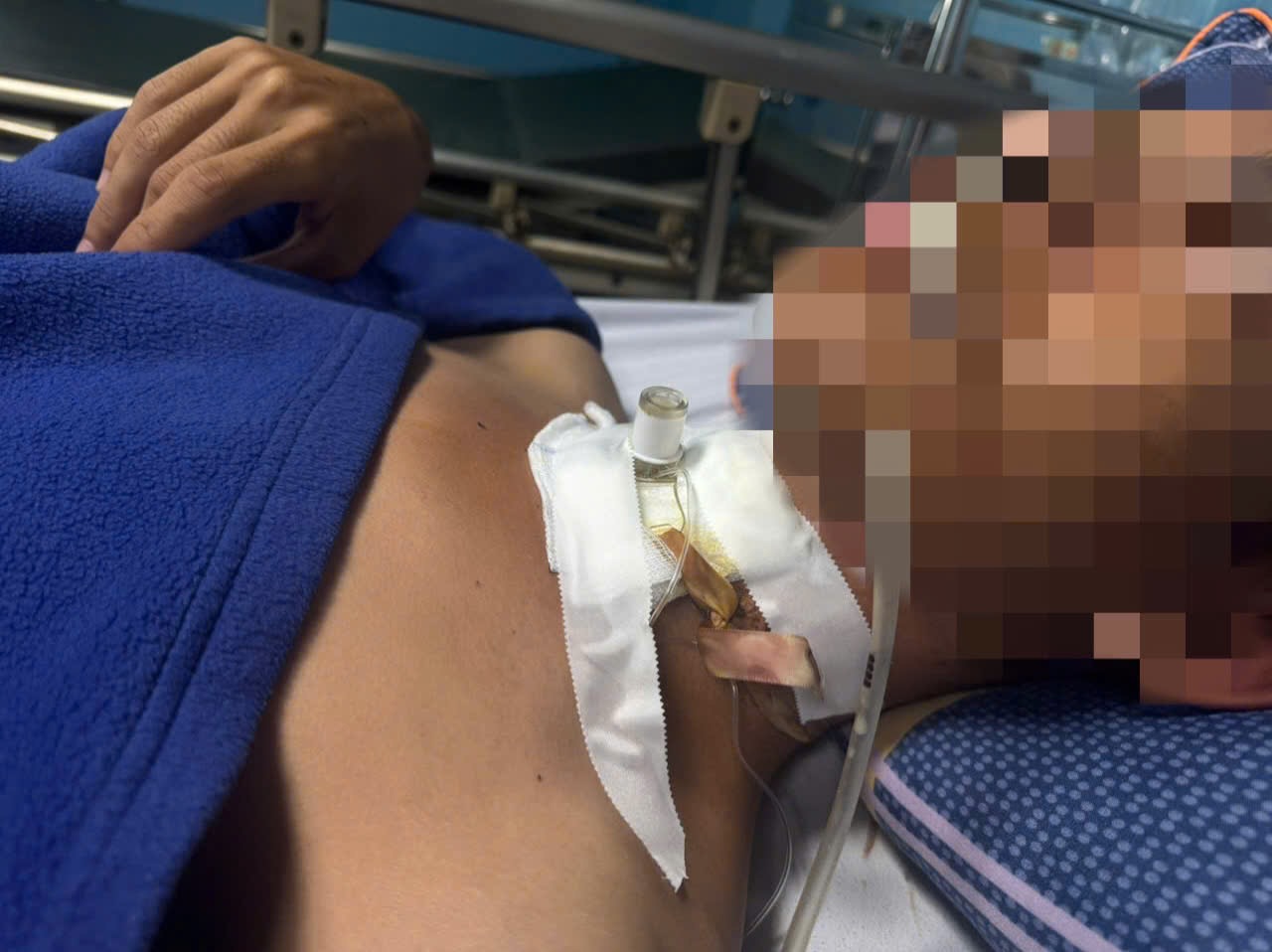 The teenager was broken in the airways by an electric wire falling in the middle of the road. Photo: Vietnam - Cuba Dong Hoi Friendship Hospital