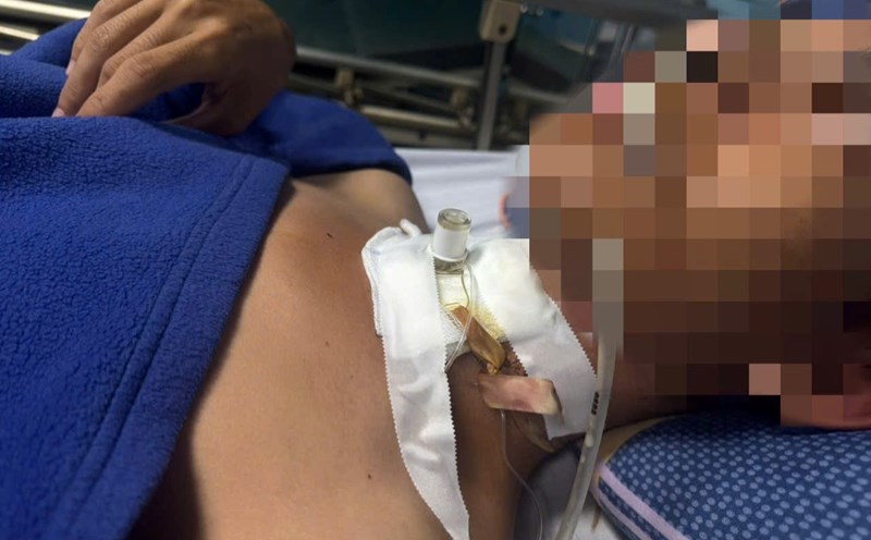 The teenager was broken in the airways by an electric wire falling in the middle of the road. Photo: Vietnam - Cuba Dong Hoi Friendship Hospital