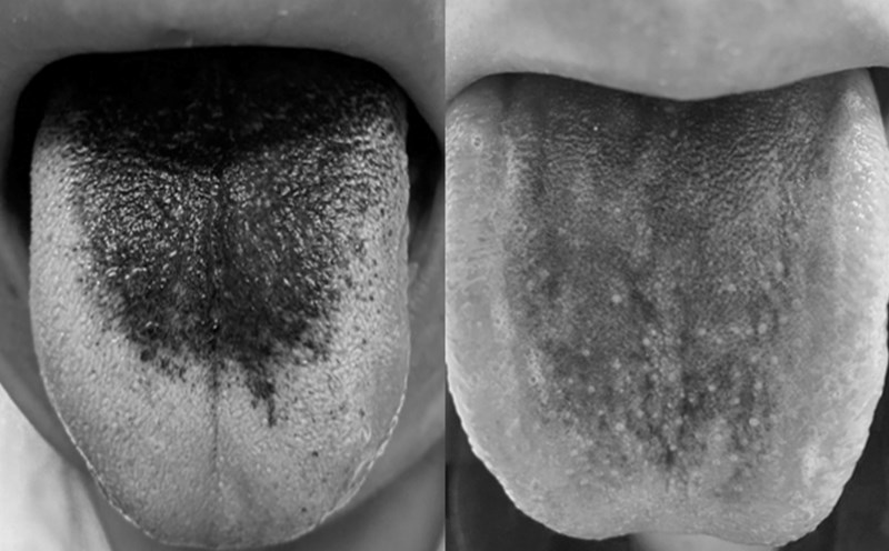 Is an unusual black tongue a dangerous disease? Photo: BVCC