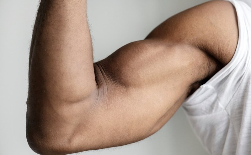 Scalp triads, a factor that determines the size of your arms. Photo: Thuy Duong