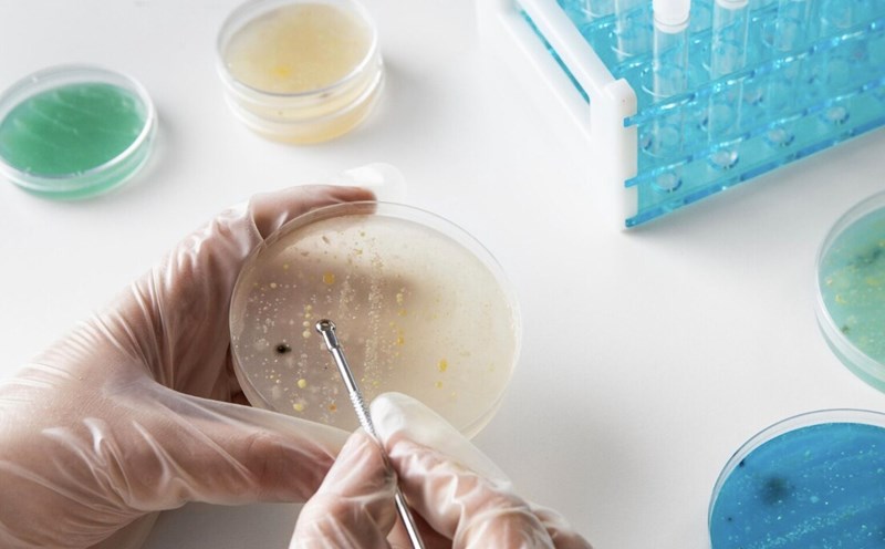 What are nightmare bacteria and why are they a concern? Photo: Thuy Duong