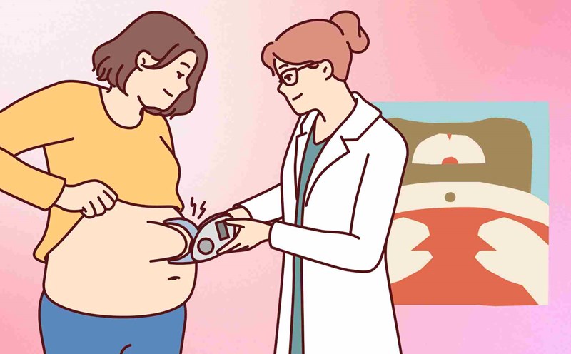 How to adjust nutrition to effectively reduce belly fat in menopausal women