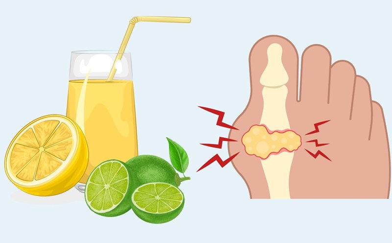 How to use lemon every day to support uric acid excretion. Graphics: Linh Dan