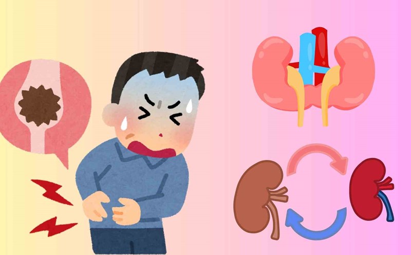 Recognizing typical pain correctly will help detect and control kidney disease more effectively. Graphics: Huyen Trang