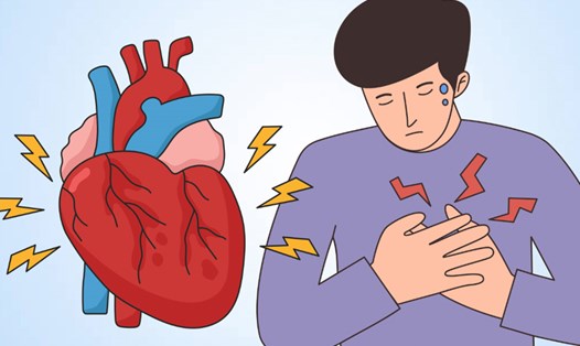 Hãy cảnh giác với những triệu chứng khó nhận biết của cơn đau tim. Đồ họa: Thiện Nhân
