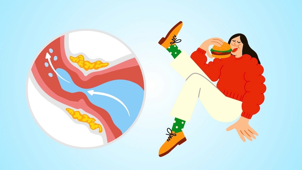 7 foods that increase uric acid.