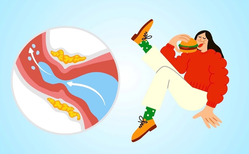 7 foods that increase uric acid.