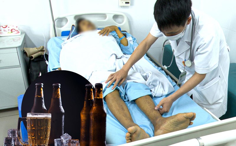 Drinking too much alcohol increases liver fibrosis cases, doctors recommend safe drinking levels