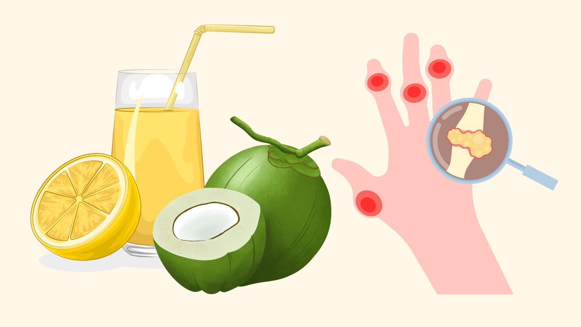 Comment reduire l'acide urique a la maison prevention rapide de la goutte. Graphique : Linh Dan