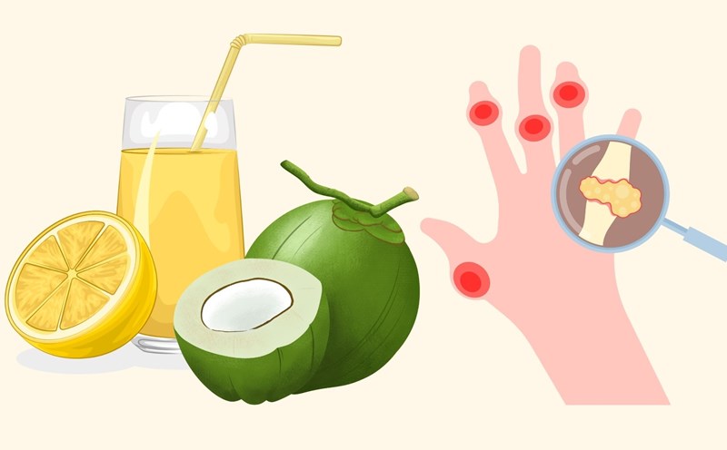 How to reduce uric acid at home, prevent acute gout. Graphics: Linh Dan