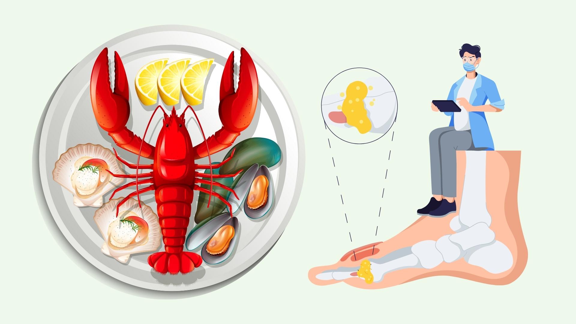Principe de manger des fruits de mer sans craindre d'augmenter l'acide urique sans craindre la goutte. Graphique : Linh Dan