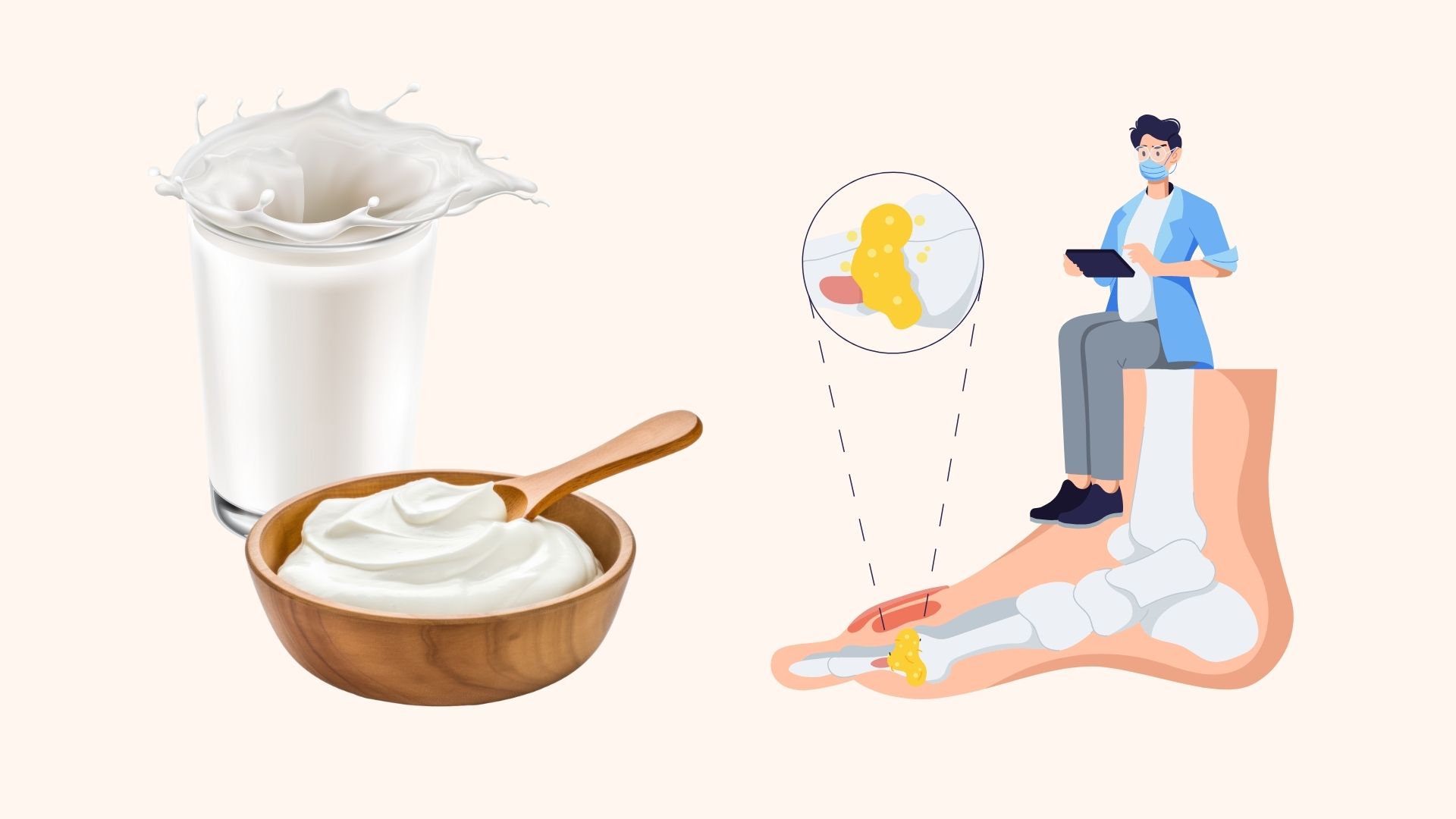 The secret to drinking milk to lower uric acid and prevent gout. Graphics: Linh Dan