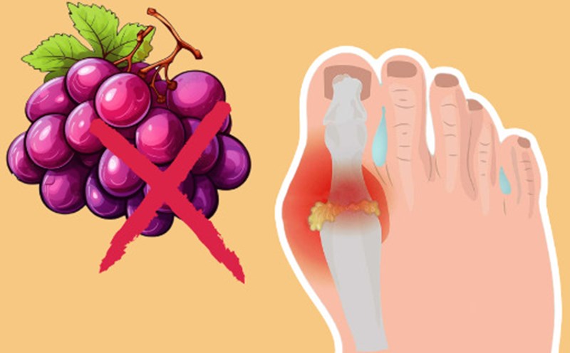 Uric acid is difficult to control - The risk of gout is lurking from the habit of eating grapes. Graphics: Phuong Thao