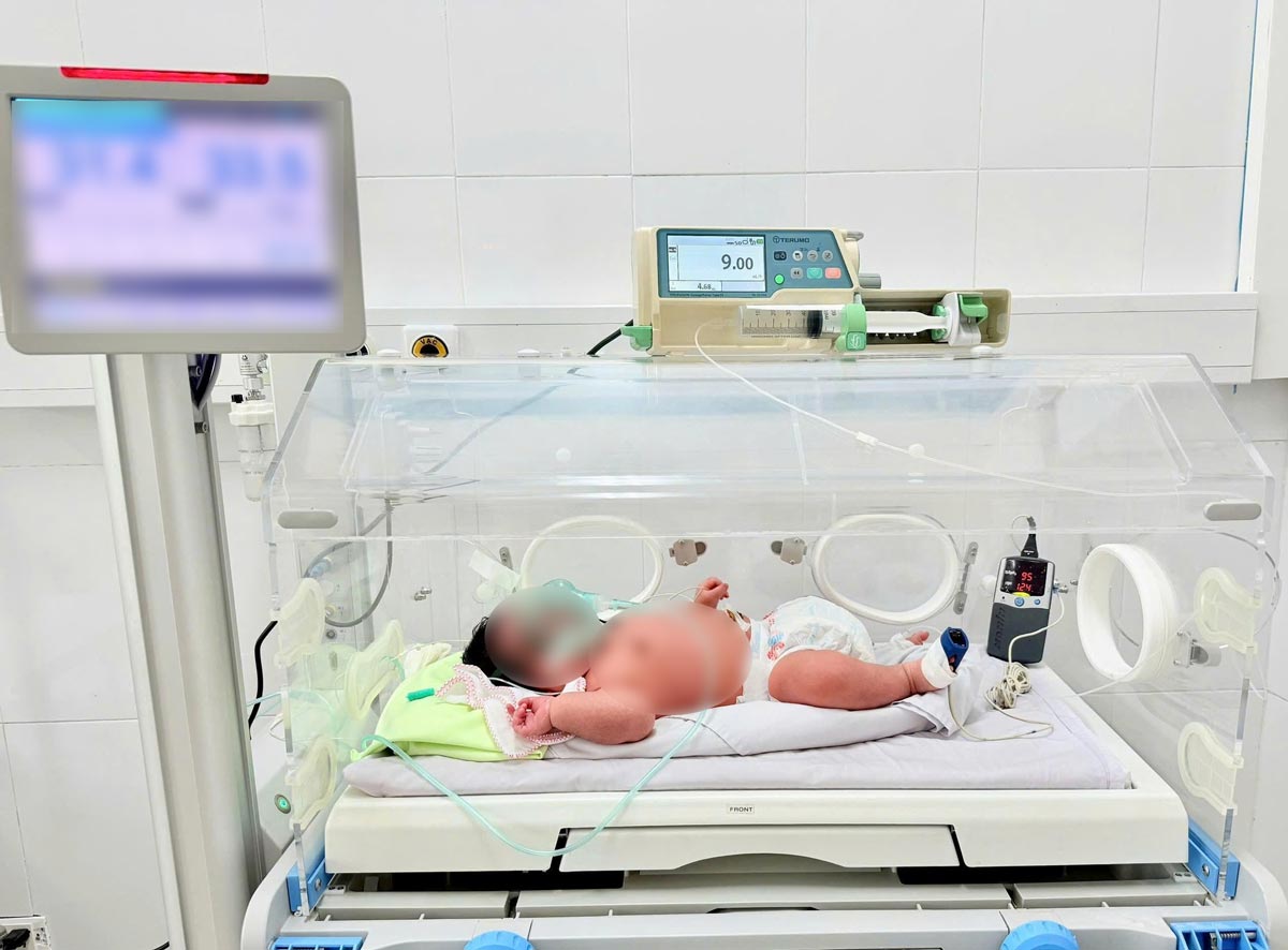 The baby was carrying 6.2kg of feathers. Photo: Cam Pha Regional General Hospital, Quang Ninh Province