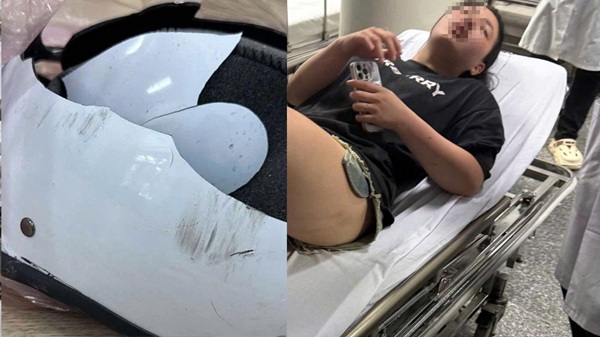 Một cô gái ở Hà Nội bị đánh hội đồng dã man lúc nửa đêm. Ảnh: L.D.A cung cấp