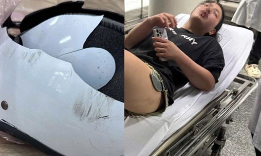 Một cô gái ở Hà Nội bị đánh hội đồng dã man lúc nửa đêm. Ảnh: L.D.A cung cấp