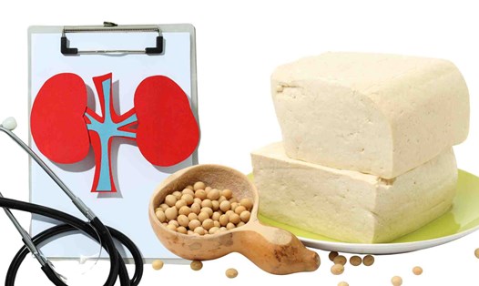 Ăn quá nhiều đậu phụ không tốt cho thận. Đồ họa: Hạ Mây